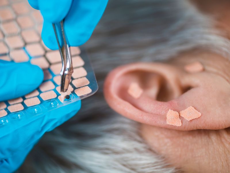 acupuntura auricular em sorocaba