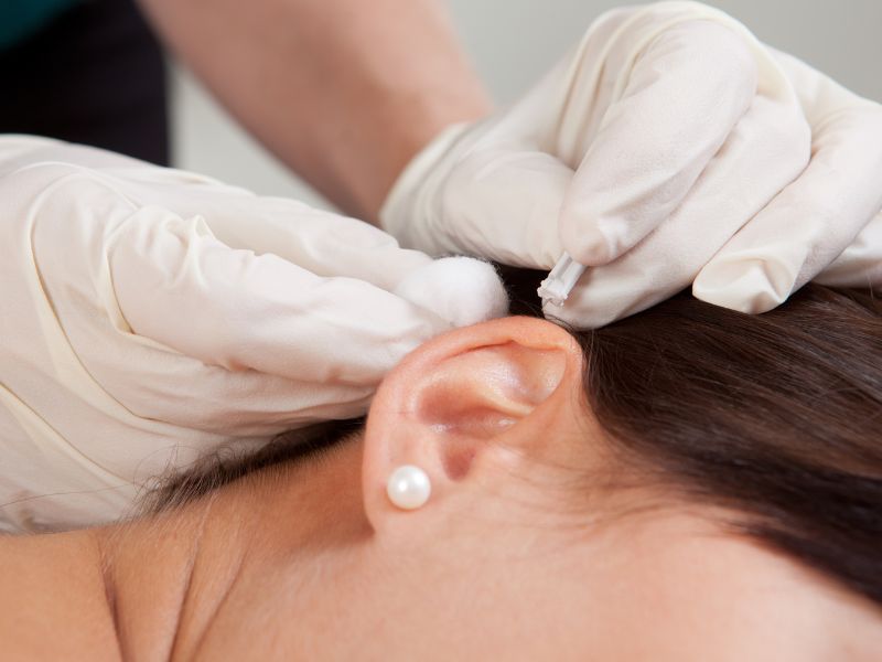acupuntura auricular em sorocaba