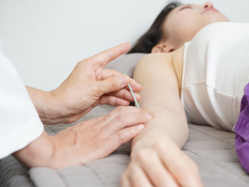 Acupuntura para criança em sorocaba