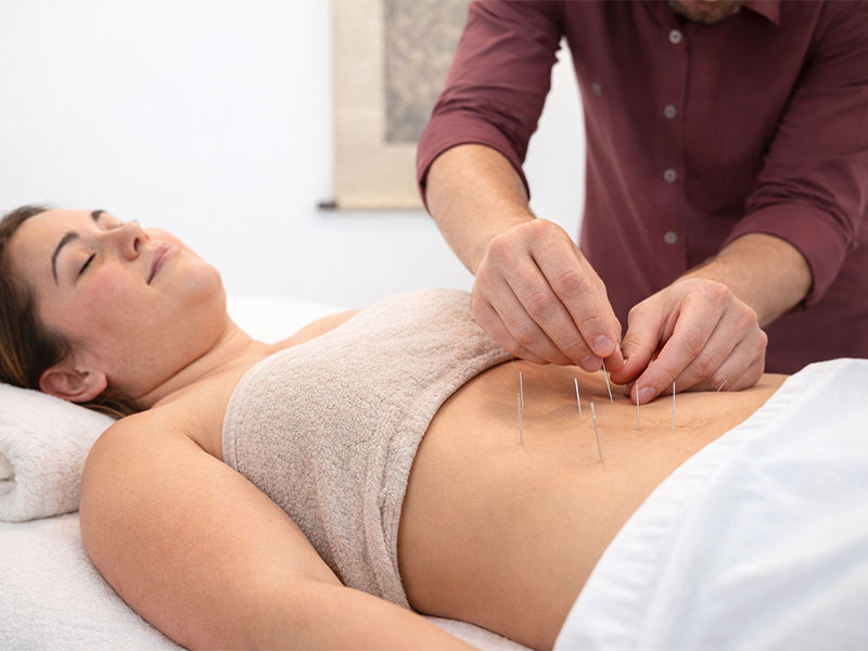 acupuntura-para-engravidar