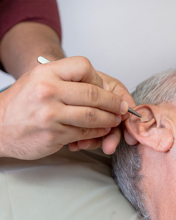 terapia Auriculoterapia